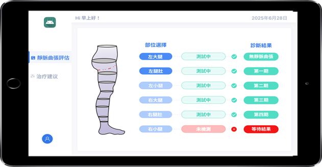 AI Ultrasound Technology